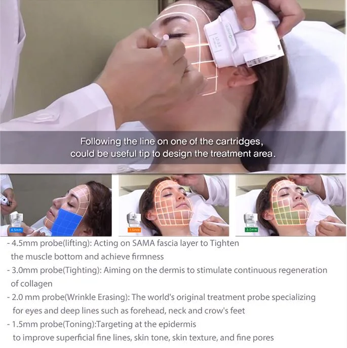 CE Medical 7D Hifu with 7 Cartridges 12 Lineshigh Intensity Focused Ultrasound Body and Face Lifting Skin Tightening Anti Wrinkle Removal Beauty Machine